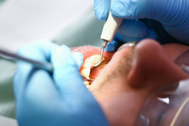 Best Broken or Chipped Tooth Repair in Harsville, RI