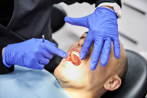 Best Knocked-Out Tooth (Avulsed Tooth) Treatment in Harsville, RI